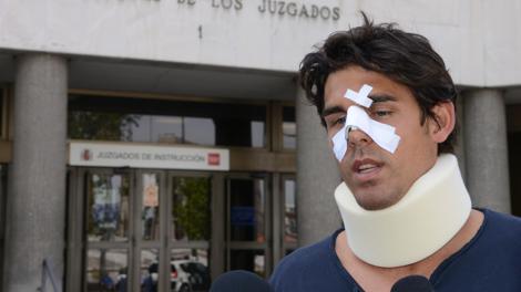 Thomas Drouet, 29 anni, con il naso rotto dopo l'aggressione di Josh Tomic. Afp
