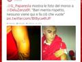 De Luca mostra il segno del morso di Comi sul braccio. FC Bari