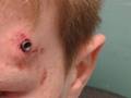 Il viso dell’11enne con il piombino sopra l’occhio sinistro. EPA