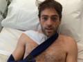 Alex Dowsett nel letto d'ospedale dopo l'operazione alla clavicola destra