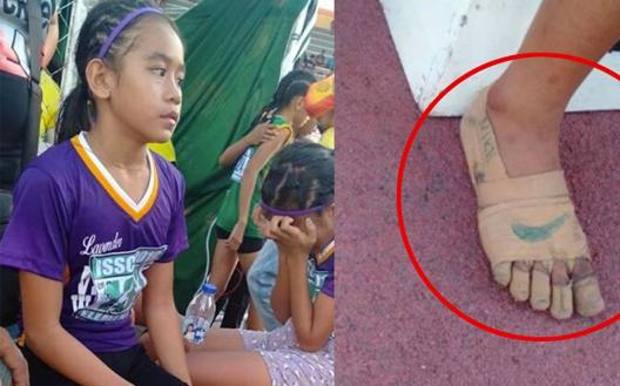 Rhea e la sua fantasia nell’aver disegnato il baffo della Nike sulle bende