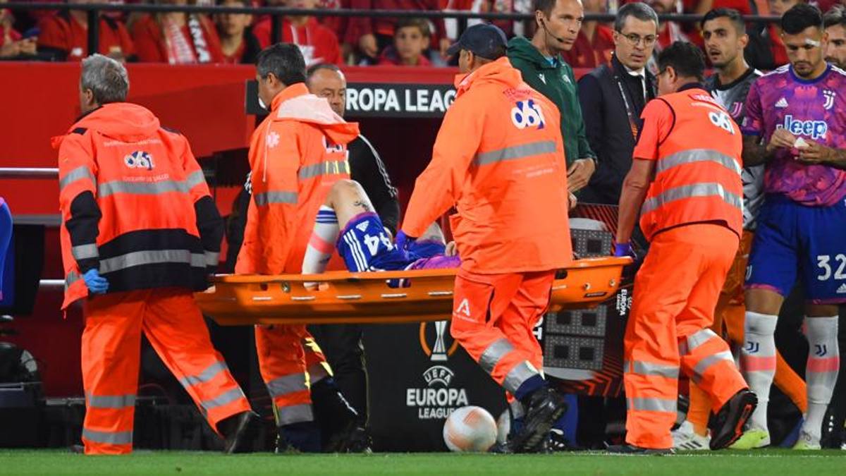 Juve, Nicolò Fagioli operato alla clavicola destra i tempi di recupero